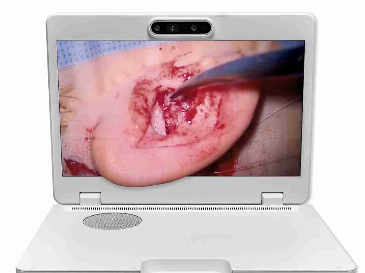 达擎之＂Heads-up 3D显微手术显示系统＂，，，，整合4K裸眼3D显示及眼球追踪系统，，具备快速追踪人眼移动位置功能，，，减轻医师长时间维持固定姿势的负担，，让医师能有更宽广清晰的3D立体视野及更舒适的姿势来执行手术。。。